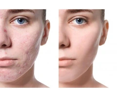 Beauty Treatments & Aesthetics | The Beauty Clinic Southsea