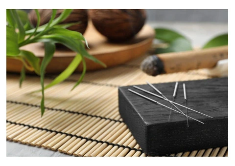 Traditional Chinese Acupuncture North London