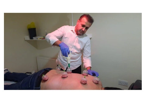Hijama Cupping Therapy: From Theory to Practice - 1/3