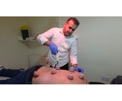 Hijama Cupping Therapy: From Theory to Practice