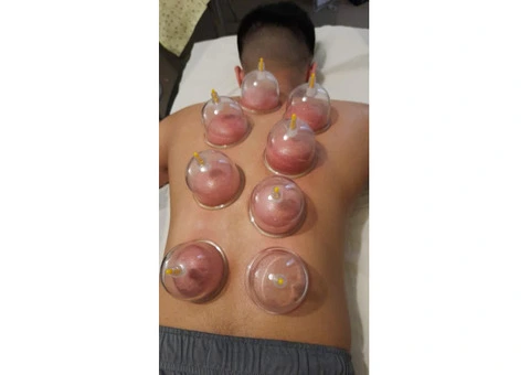 Hijama Cupping Therapy: From Theory to Practice - 2/3