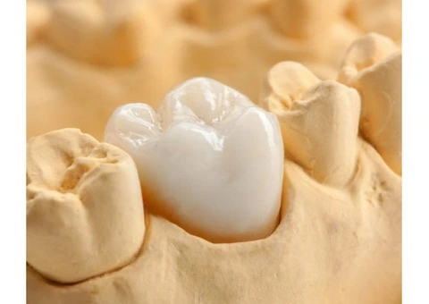 Dentist Bayswater - Dentist Near Me | The Good Dentists Group - 5/11