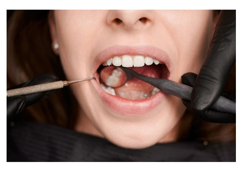 The Truth About Root Canal Side Effects | Why You Shouldn’t Be Afraid
