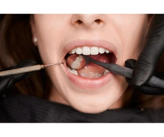 The Truth About Root Canal Side Effects | Why You Shouldn’t Be Afraid