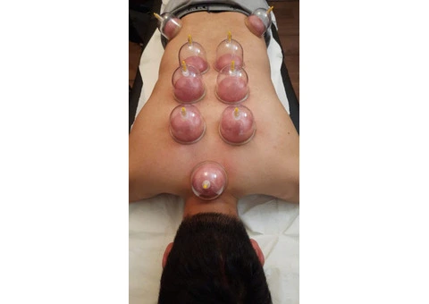 Professional Certificate in Hijama Cupping Therapy - 2/3