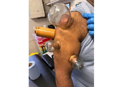 Hijama Cupping Diploma Course – UK Accredited Training - 2/3