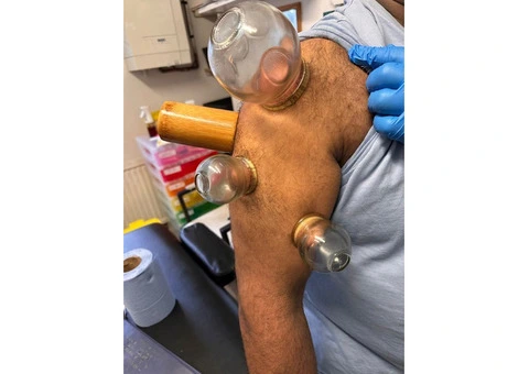Hijama Cupping Diploma Course – UK Accredited Training - 3/3
