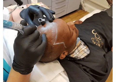 Hair Tattoo for Men London – True Scalp Clinic