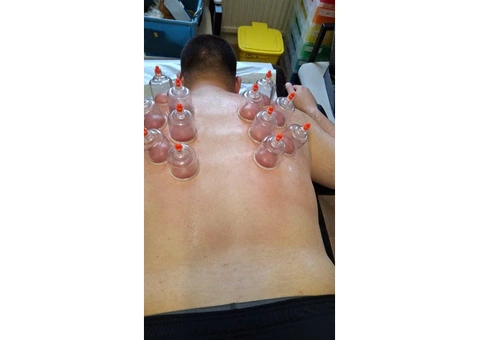 Start Your Journey with Hijama Cupping Therapy! ✨ - 3/3