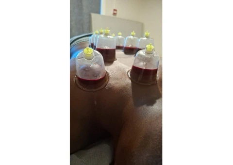 Hijama Cupping Training London | Accredited Hijama Course by D2D Therapies - 2/3