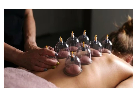 Rejuvenate Your Body with Expert Cupping Therapy in London