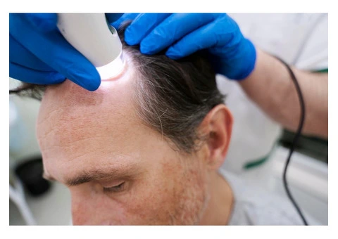 Get the Best Hair Transplant in the UK – Book Your Appointment Today! - 7/7