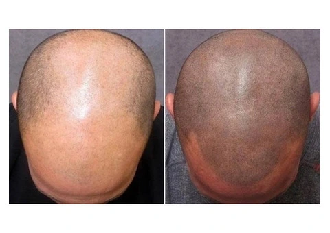 Differences Between Hair Tattoo vs Body Tattoo (maintenance)