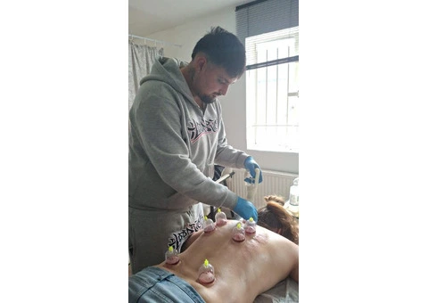 Accredited Hijama Training Program – Master the Art of Cupping Therapy