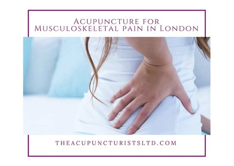 Acupuncture for Stress in London - 5/12