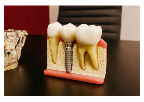 Composite Bonding in Aberdeenshire – Natural Smile Enhancement at Turriff Dental Care - 3/3
