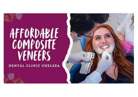 Affordable Composite Veneers at Dental Clinic Chelsea