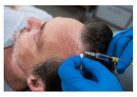 Advanced FUE & DHI at a Leading UK Hair Transplant Clinic