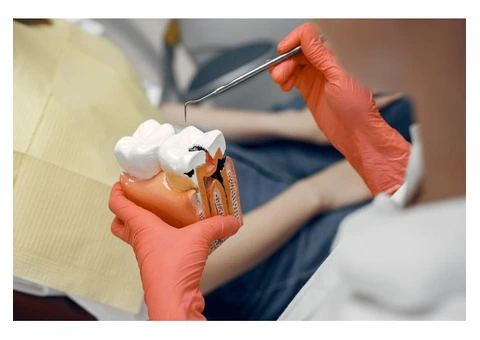Dental Crown Treatment London – Restore Your Smile with Expert Care