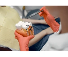 Dental Crown Treatment London – Restore Your Smile with Expert Care