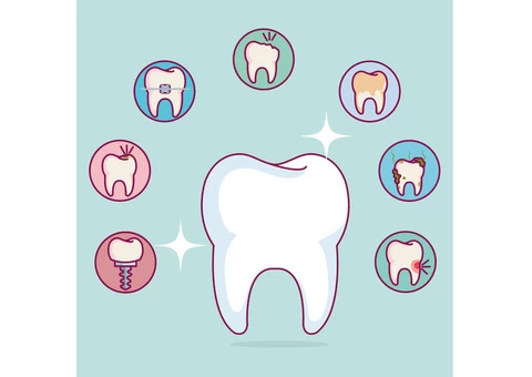 Types of Dental Services