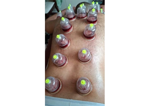 Advanced Wet & Dry Cupping Therapy Certification