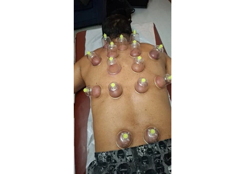 Professional Diploma in Hijama & Cupping Therapy Course - 3/3