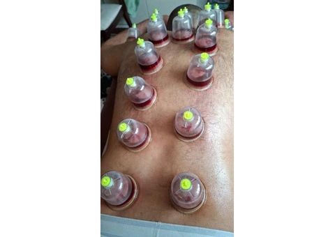 🌙 Sunnah Healing: Hijama Cupping Therapy Course - 2/2