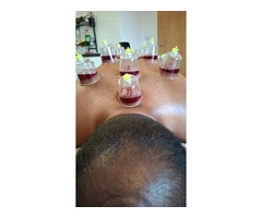 Certified Hijama Cupping Therapy Course
