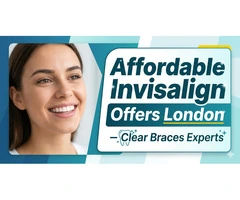 Affordable Invisalign Offers London – Clear Braces Experts
