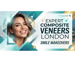 Expert Composite Veneers London – Smile Makeovers