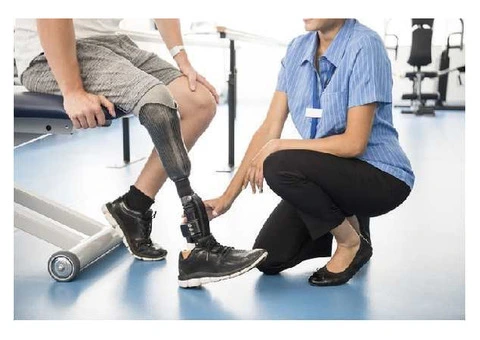 Trusted Legal Support for Amputation Claims in the UK