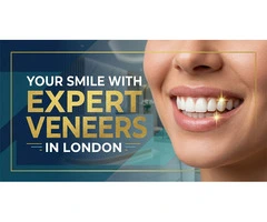 Enhance Your Smile with Expert Veneers in London