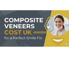 Composite Veneers Cost UK for a Perfect Smile Fix