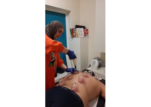 Join London’s Leading Hijama Cupping Training – Enroll Now - 1/5