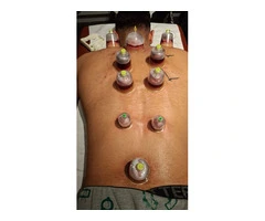 Master Hijama Cupping – Complete Beginner to Advanced Course