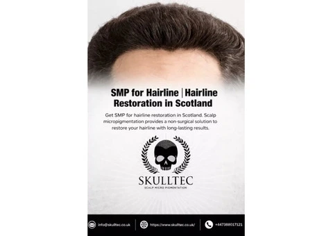 SMP for Hairline Restoration in Scotland | Natural Hairline Solutions