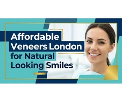 Affordable Veneers London for Natural Looking Smiles