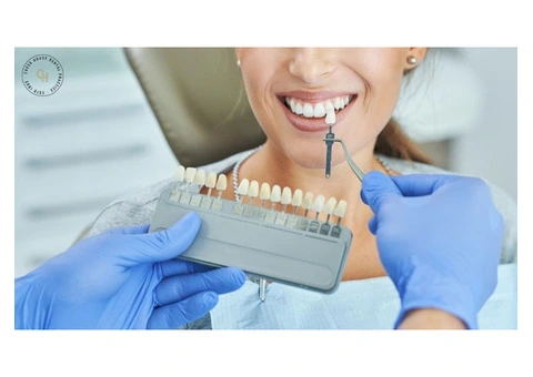 Tooth Discolouration: Why Teeth Lose Their Whiteness