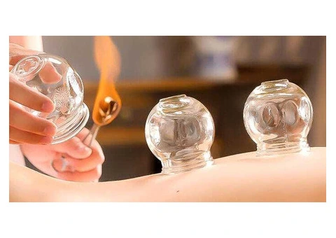 Fire Cupping Course in London – Certified Training for Beginners & Professionals