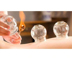 Fire Cupping Course in London – Certified Training for Beginners & Professionals