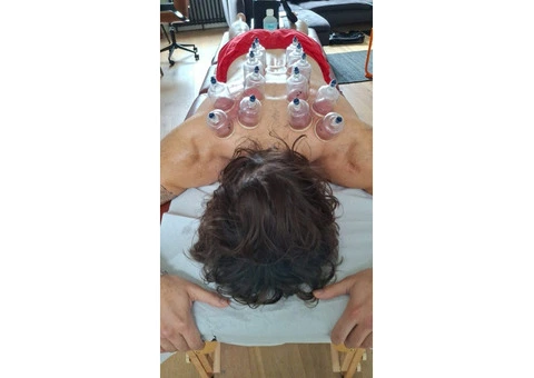 Master the Art of Healing: Professional Hijama Cupping Certification - 1/3