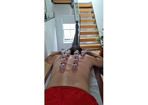 Master the Art of Healing: Professional Hijama Cupping Certification - 2/3
