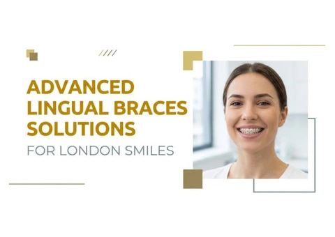 Advanced Lingual Braces Solutions for London Smiles