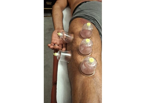 🌟 BECOME A CERTIFIED HIJAMA CUPPING THERAPIST IN JUST 1 DAY! 🌟 - 2/2