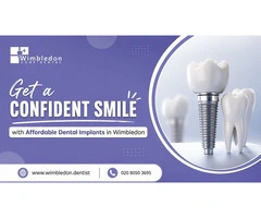 Get a Confident Smile with Affordable Dental Implants in Wimbledon