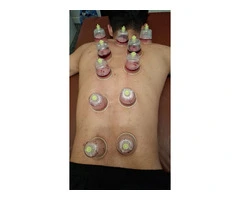 🔥 BECOME A CERTIFIED HIJAMA THERAPIST IN LONDON 🔥