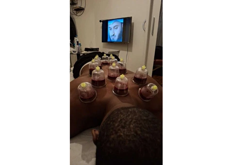 🎓 Professional Hijama Cupping Therapy Course – London