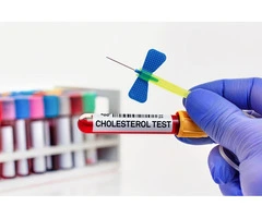 What are 10 warning Signs of High Cholesterol?