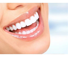 Smile Makeover bromley for a Brighter Smile